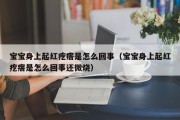 宝宝身上起红疙瘩是怎么回事（宝宝身上起红疙瘩是怎么回事还微烧）